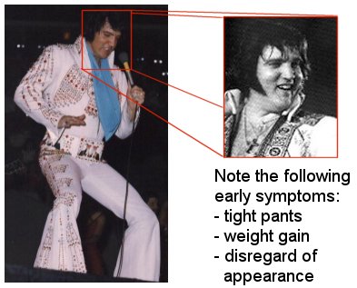 Stage 2 - Elvis